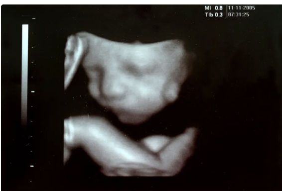 Forget Medical Science. When Life Begins is Based on Your Feelings