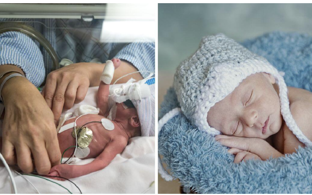 Premature baby born weighing barely more than a bag of sugar now thriving at 18 months